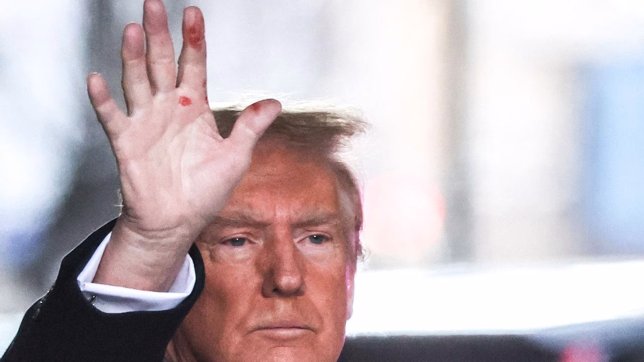 While the official explanation may sound plausible, it hasn’t put every concern to rest. Trump’s past handling of his own health disclosures continues to fuel skepticism. During his first presidential campaign, he famously dictated the glowing statement that was later released under his doctor’s name, raising doubts about its credibility. Adding to that history, there were reports that his longtime physician, Dr. Harold Bornstein, had his office raided by Trump’s associates, who allegedly demanded and removed the president’s medical records. For many people, episodes like these make it difficult to take current reassurances at face value.